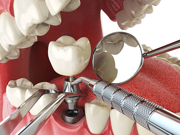 Best Emergency Treatment for Oral Infections in Schertz, TX